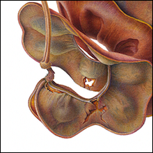 Tulip Sirius - Parachidendron Pruinosum